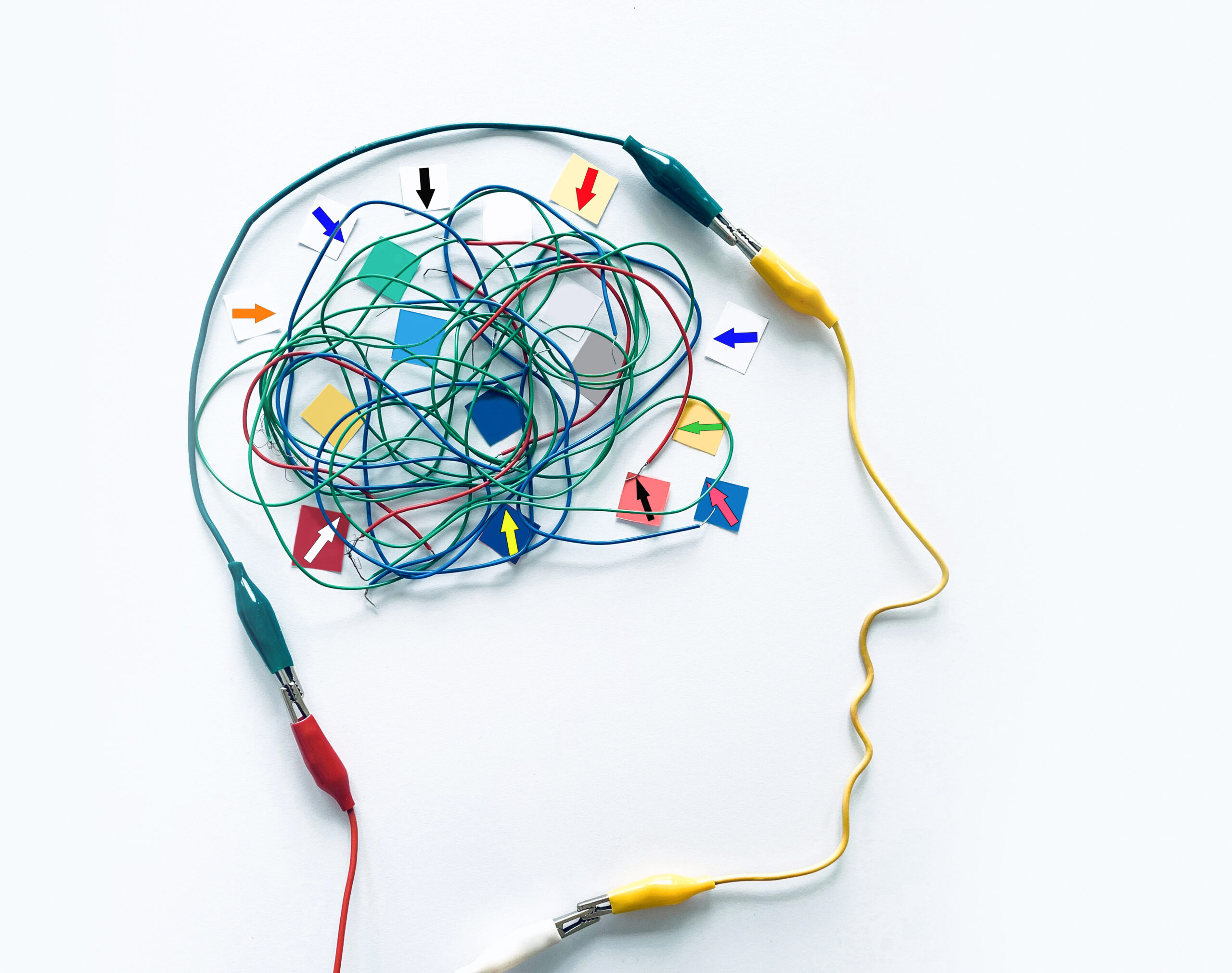 flat lay of head and brain made with electrical connections highlighting how long to rewire brain from addiction